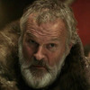 'Game of Thrones' Actor's Ear Bitten Off in Hotel Attack