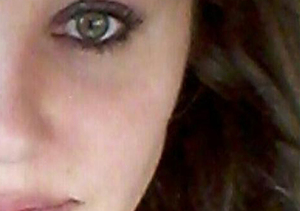 Did Amanda Bynes Get Plastic Surgery to Remove Webbing?