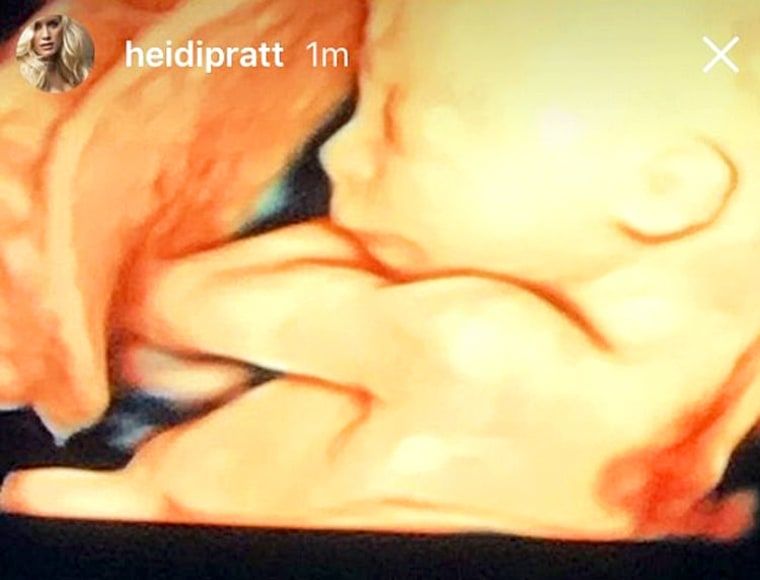 heidi-montag-snapchat-zoom-57461db8-d597-40cc-9ff1-9ad0b59a1aa5