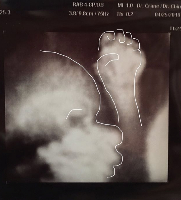 erika-christensen-sonogram-insta