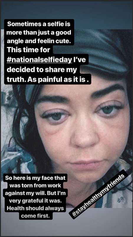hyland-instagram-story1