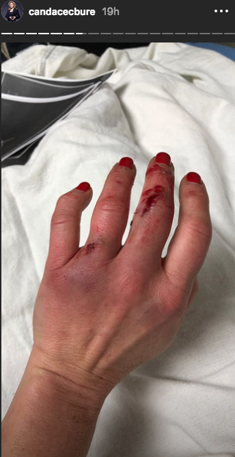 candace-bure-hand-instagram