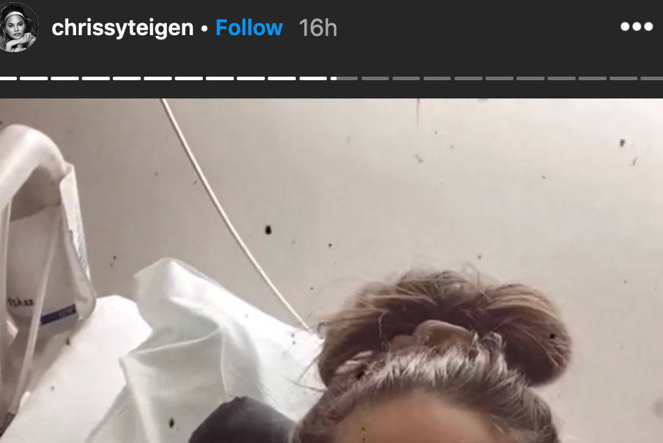 Chrissy Teigen’s Latest Health Update After 2 Blood Transfusions